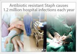 Is MRSA Contagious?